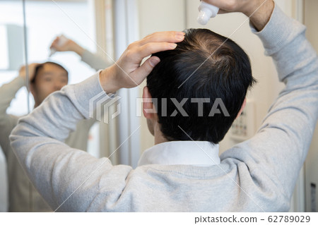 Middle aged man suffering thin hair 62789029