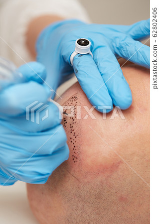 professional tattooist making permanent make up tricopigmentation 62802406