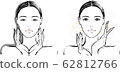 Woman Single Eyelid Before Before 62812766