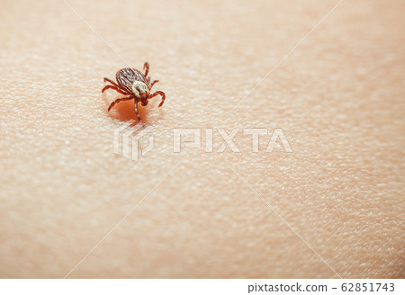 Tick on skin Tick on skin 62851743