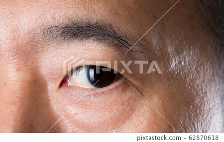 Body Part Eye Eyelash skin close up Body Part Eye Eyelash skin close up 62870618