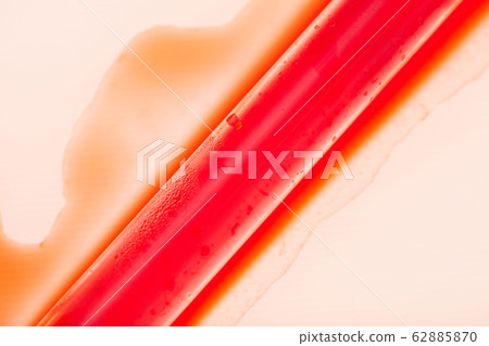 Spilled Blood Test in Laboratory 62885870