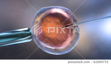 Artificial insemination or in vitro fertilization 62894733