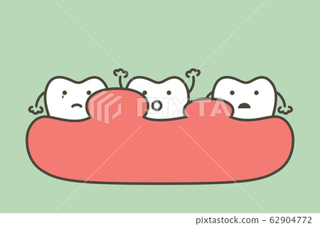 unhealthy teeth because gingivitis or gum disease with abscess, gum is swollen 62904772