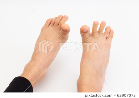 Toe stretching Toe stretching 62907072