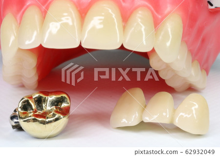 Tooth 62932049