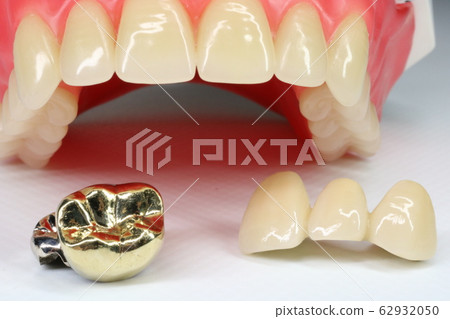 Tooth 62932050