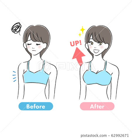 Bust Up Before After 62992671