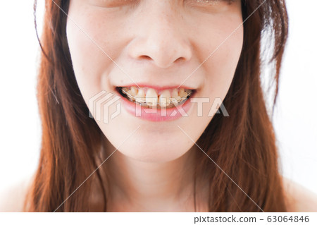 Young woman doing orthodontics Young woman doing orthodontics 63064846
