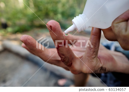 A man treats a cut with peroxide, disinfects a wound while sitting in a forest A man treats a cut with peroxide, disinfects a wound while sitting in a forest 63134057