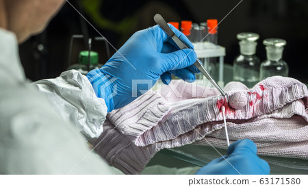 Coroner removes blood on clothes, criminal investigation 63171580