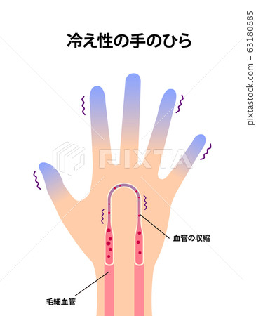 帶有冷端插圖的手(感冒的原因)/英文 帶有冷端插圖的手(感冒的原因)/英文 63180885