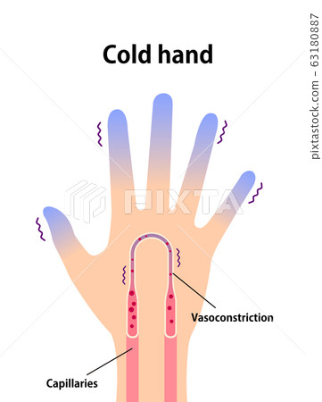 Hand with cold end illustration (Cause of cold) / English 63180887