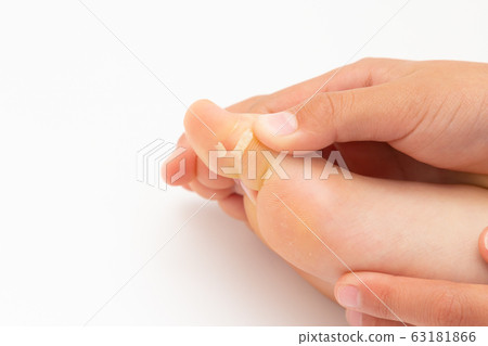 腳趾麻煩 腳趾麻煩 63181866