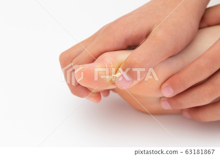 腳趾麻煩 腳趾麻煩 63181867
