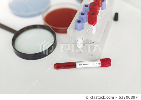 Coronavirus testing samples with bottles solutions inside and a loupe on a table 63200897