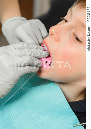 The boy orthodontist makes a fitting for the 63281754
