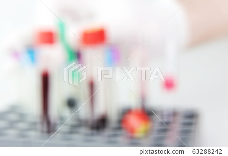 2019-nCoV laboratory testing for suspected human 2019-nCoV laboratory testing for suspected human 63288242