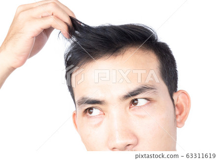 Young man serious hair loss problem for health Young man serious hair loss problem for health 63311619