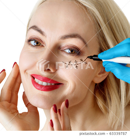 Beautiful woman face with correction lines for plastic surgery. 63339787