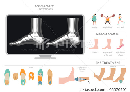 Medical infographics_1_2 63370501