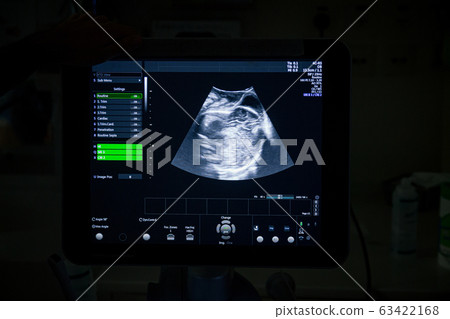 Medical ultrasound machine with a 4D image Medical ultrasound machine with a 4D image 63422168