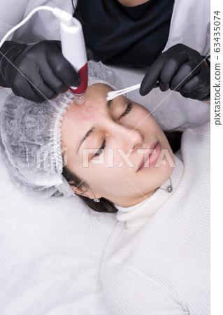 Micro needle mesotherapy. Derma pen Micro needle mesotherapy. Derma pen 63435074