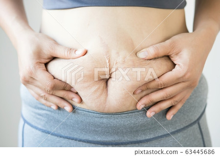 Obese women want to lose weight Obese women want to lose weight 63445686