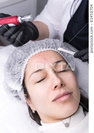 Micro needle mesotherapy. Derma pen Micro needle mesotherapy. Derma pen 63458704