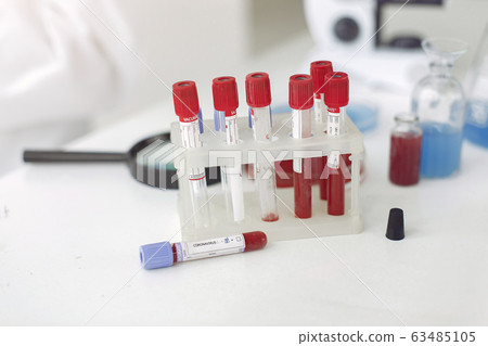 Coronavirus testing samples with bottles solutions inside and a loupe on a table 63485105