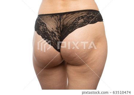 buttocks with cellulite buttocks with cellulite 63510474