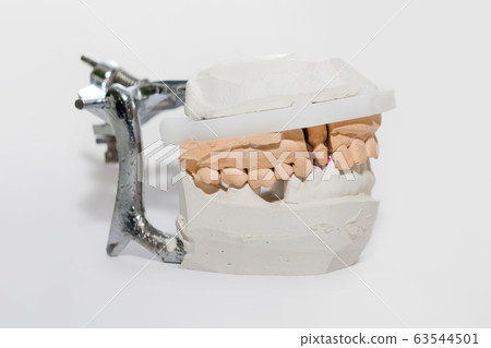 Plaster Cast of jaws. Dental casting gypsum model Plaster Cast of jaws. Dental casting gypsum model 63544501