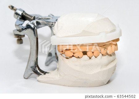 Plaster Cast of jaws. Dental casting gypsum model Plaster Cast of jaws. Dental casting gypsum model 63544502