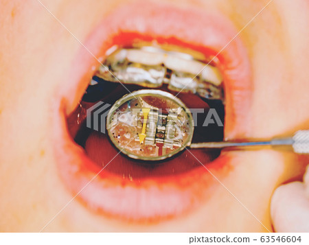 Dentist control of braces in young boy mouth 63546604