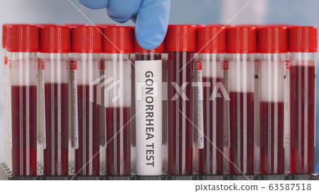 Hand wearing protection glove puts vial with gonorrhea test in the tube rack Hand wearing protection glove puts vial with gonorrhea test in the tube rack 63587518