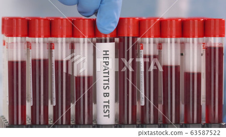 Hand wearing protection glove puts vial with hepatitis B test in the tube rack Hand wearing protection glove puts vial with hepatitis B test in the tube rack 63587522