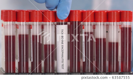 Hand wearing protection glove puts vial with tick-borne encephalitis TBE test in the tube rack 63587555