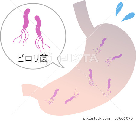 幽門螺桿菌胃圖像圖 63605079