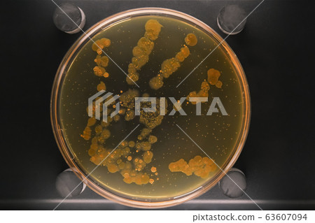 Petri dish with a colony of bacteria on a dirty hand Petri dish with a colony of bacteria on a dirty hand 63607094