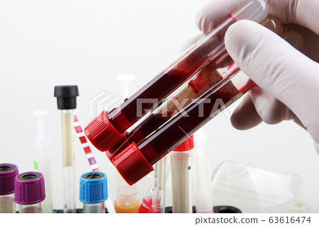 Coronavirus disease (COVID-19) research. Blood 63616474