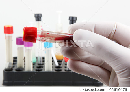 Coronavirus disease (COVID-19) research. Blood Coronavirus disease (COVID-19) research. Blood 63616476