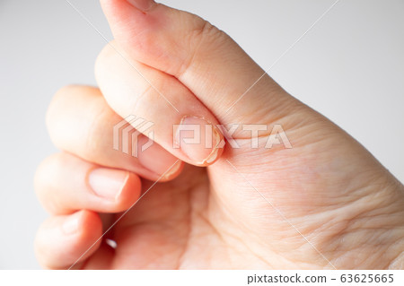Double nail 63625665