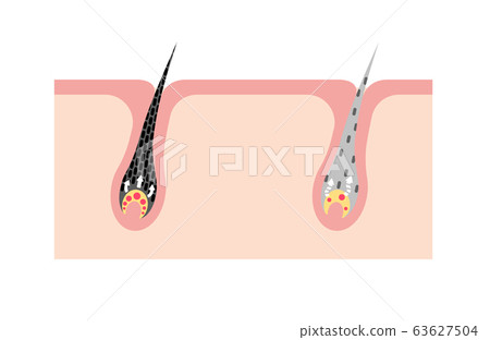 Black hair and gray hair Comparison of the mechanism and mechanism of occurrence Skin cross-sectional view illustration / No characters 63627504