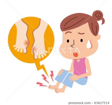 Hallux valgus woman illustration 63627514
