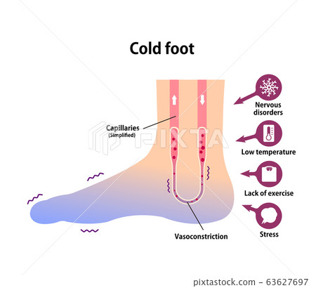 Chilled feet illustration (Causes of coldness) / English 63627697