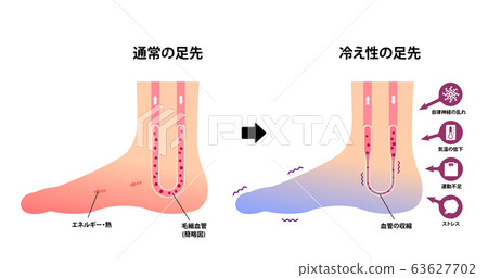Comparison of normal feet and feet with cold ends (cause of cold) 63627702