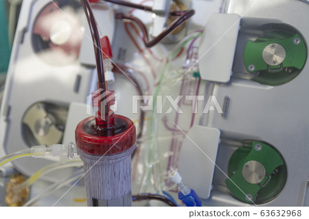Dialyzer with two upper ports, on background dialysis machine in ICU in hospital 63632968