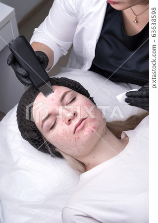 Ultrasonic face peel Ultrasonic face peel 63638598