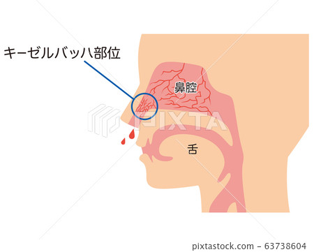 Kieselbach site nose structure 63738604