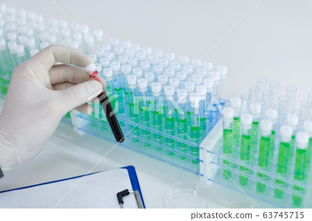 Close up photo of a doctor's hands with a test tube with a blood sample. A lot of test tubes on background. Close up photo of a doctor's hands with a test tube with a blood sample. A lot of test tubes on background. 63745715